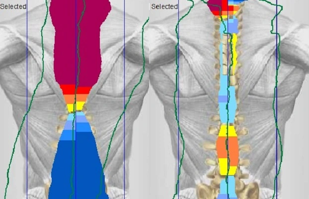 Chiropractic White Marsh MD Infared