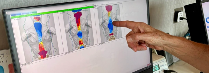 A hand pointing to spinal scan results displayed on a computer monitor.
